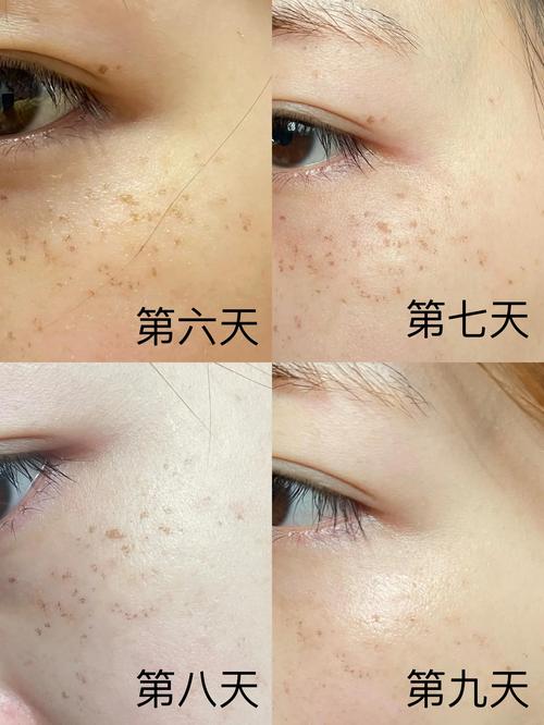 ps磨皮后恢复皮肤真实质感教程